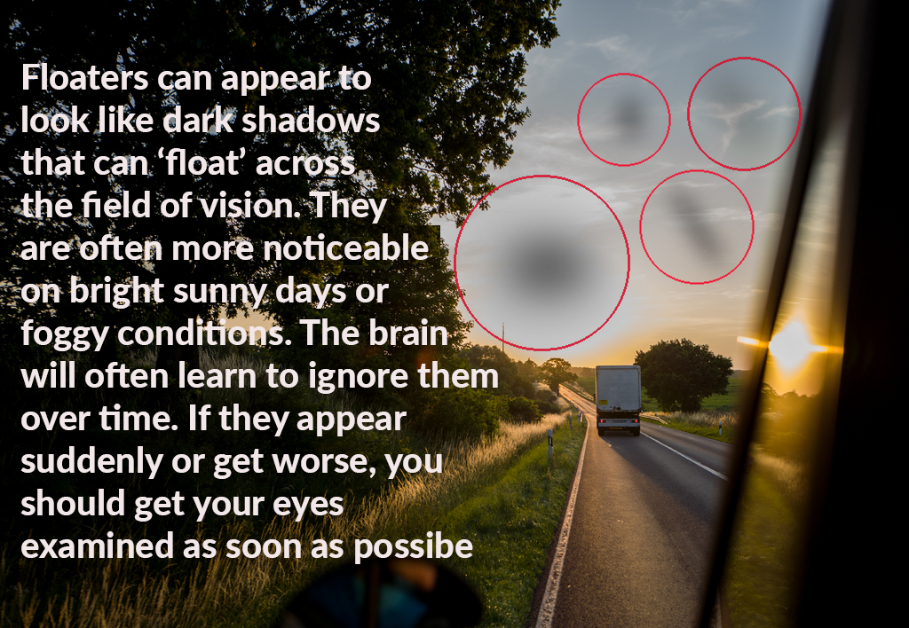 Driver with eye floaters view from car explained